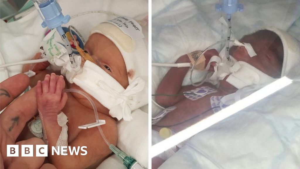 Babies died after London hospital’s neglect