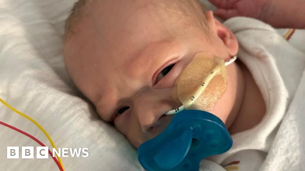 NHS apology after baby given wrong breast milk