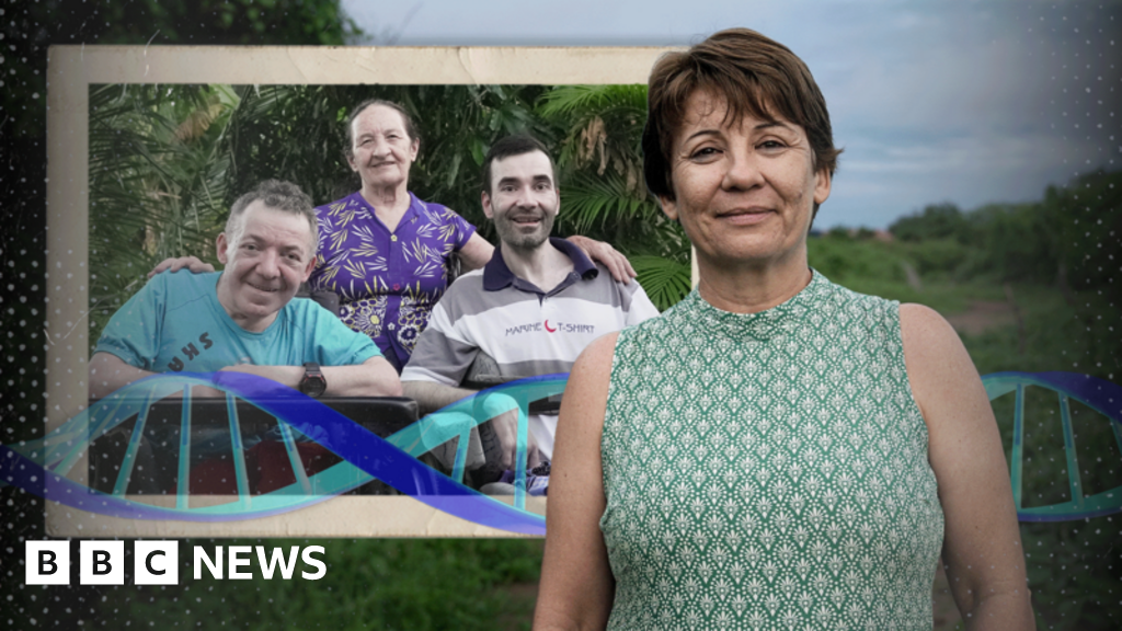 Rare condition in Brazil town popular for cousin marriage